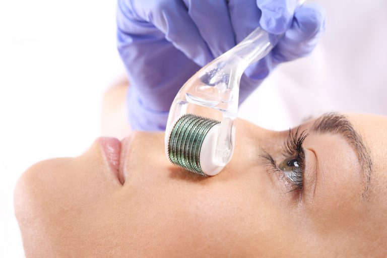 Micro-Needling-traitement-aiguilles-peau