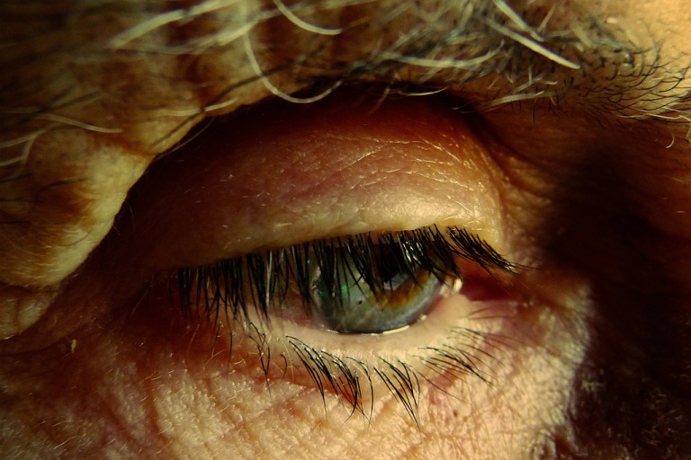 blog-alzheimer