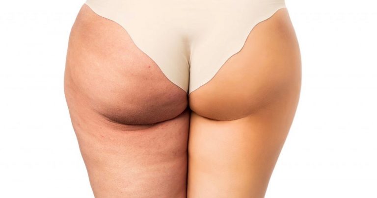 On a testé pour vous : la technologie CelluSkin